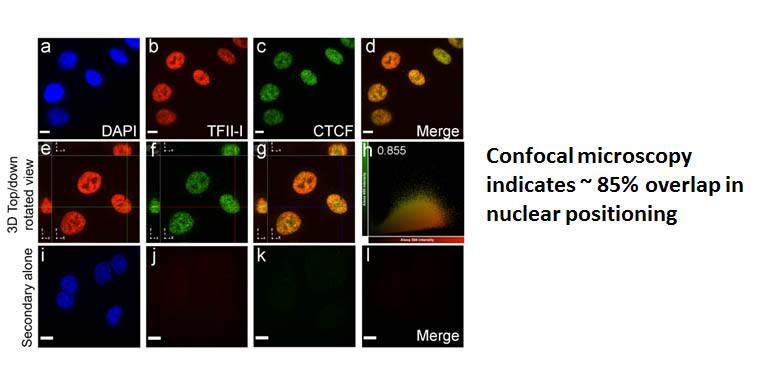 Michael Witcher 6 Confocal